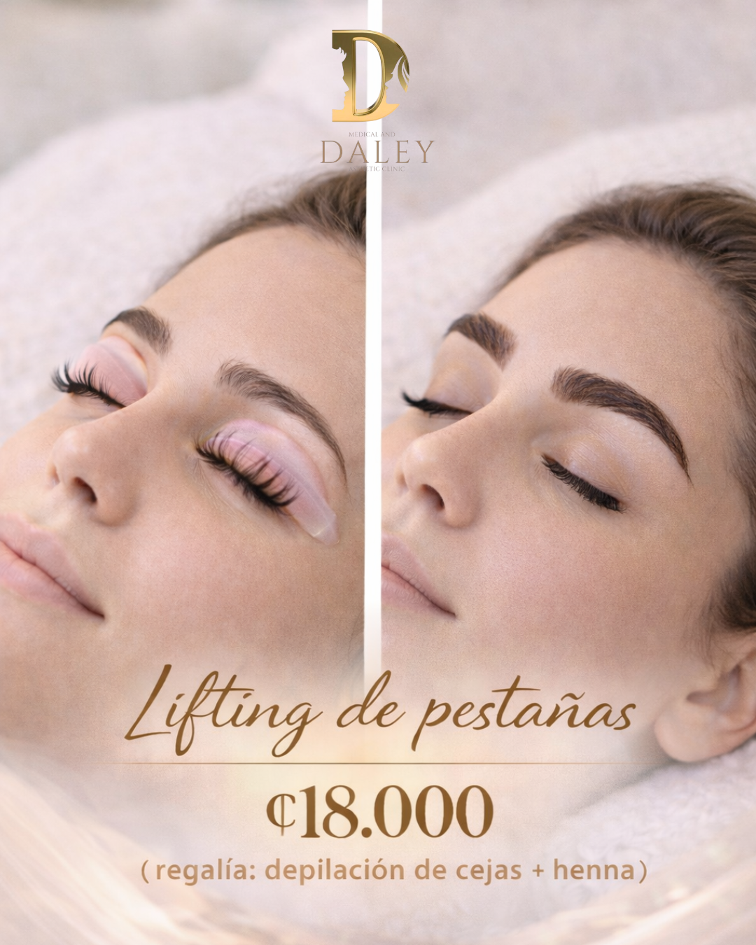 Lifting de Pestañas — ₡18,000